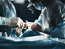 Российский хирург назвала оптимальный возраст для первой пластики