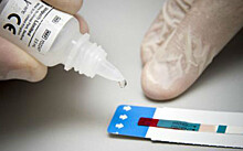 Жители Подмосковья смогут пройти экспресс-тестирование на ВИЧ-инфекцию по месту жительства
