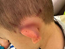 Ротвейлеры напали на детей в поселке под Москвой, возбуждено уголовное дело