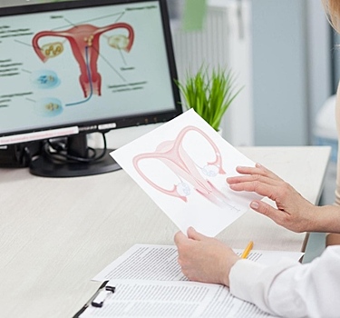 Желтое тело в яичнике: что это