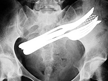 12 снимков доказывают: идиотизм неистребим