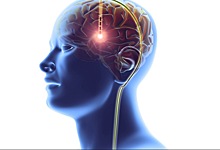 Стимуляция головного мозга является эффективным средством для лечения анорексии