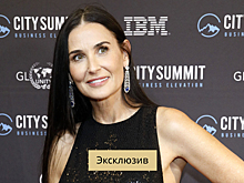 Кто из звезд делал пластику в 2021 году и зачем? Разбираем с хирургом