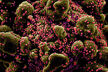 Число зараженных коронавирусом в мире перевалило за 95 млн