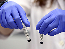 В России предложили признать ВИЧ-диссидентские организации экстремистскими