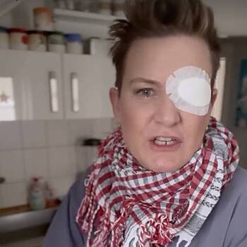 Телеведущая лишилась глаза во время празднования Нового года