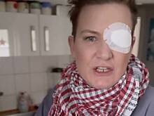 Телеведущая лишилась глаза во время празднования Нового года