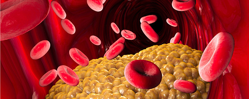 Ученые открыли новый способ снижения «плохого» холестерина в крови