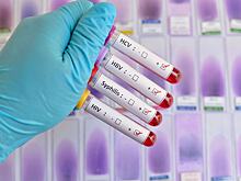 Юристы рассказали, можно ли наказать партнёра по всей строгости закона за заражение венерической болезнью