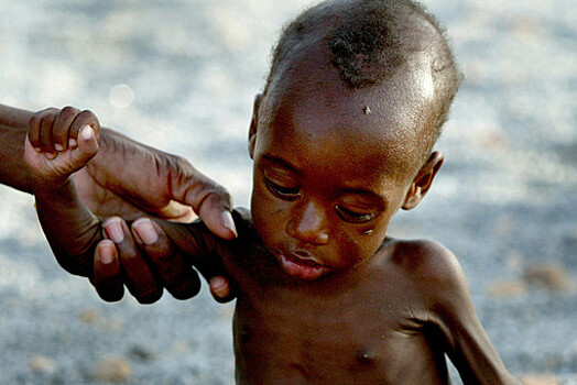 ООН: 20 странам по всему миру угрожает острый голод