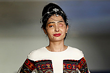 Модель с обожженным кислотой лицом открыла показ мод в Нью-Йорке