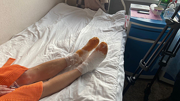 Астраханка получила сильное обморожение ног, провалившись под лед