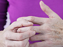 Диетолог назвал популярные продукты, усиливающие боль при артрите