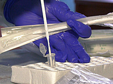 Медики подтвердили «омикрон» у одного из жителей Югры