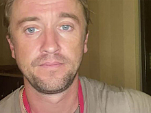 Актер из «Гарри Поттера» рассказал о своем самочувствии после госпитализации