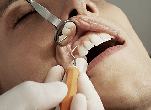 Стоматолог: гигиена полости рта — залог здоровья всего организма