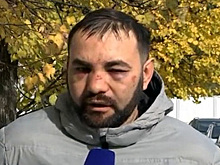 Побитый Мамаевым водитель потратил на лечение сотни тысяч рублей