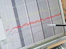 Клуб Второй лиги после неудачных матчей проверял футболистов на полиграфе