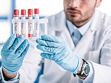 Доказана особая опасность COVID-19 относительно гриппа