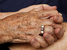 Почему у пожилых появляются пигментные пятна