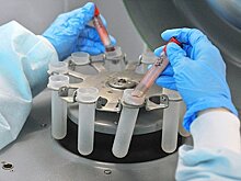 Россияне пожаловались на нехватку препаратов для лечения ВИЧ