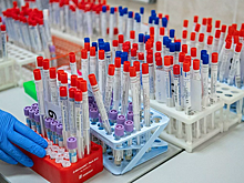 Медсестра из краснодарской больницы рассказала о работе по борьбе с COVID-19