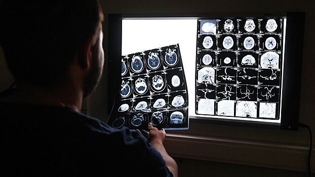 Нейропластичность: как мозг меняется, учится и восстанавливается