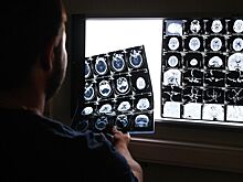 В РФ создали нейросеть для диагностики болезни Паркинсона