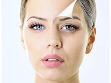 5 причин сделать пластику сегодня