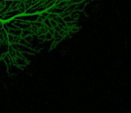 Преждевременные роды нарушают развитие мозжечка