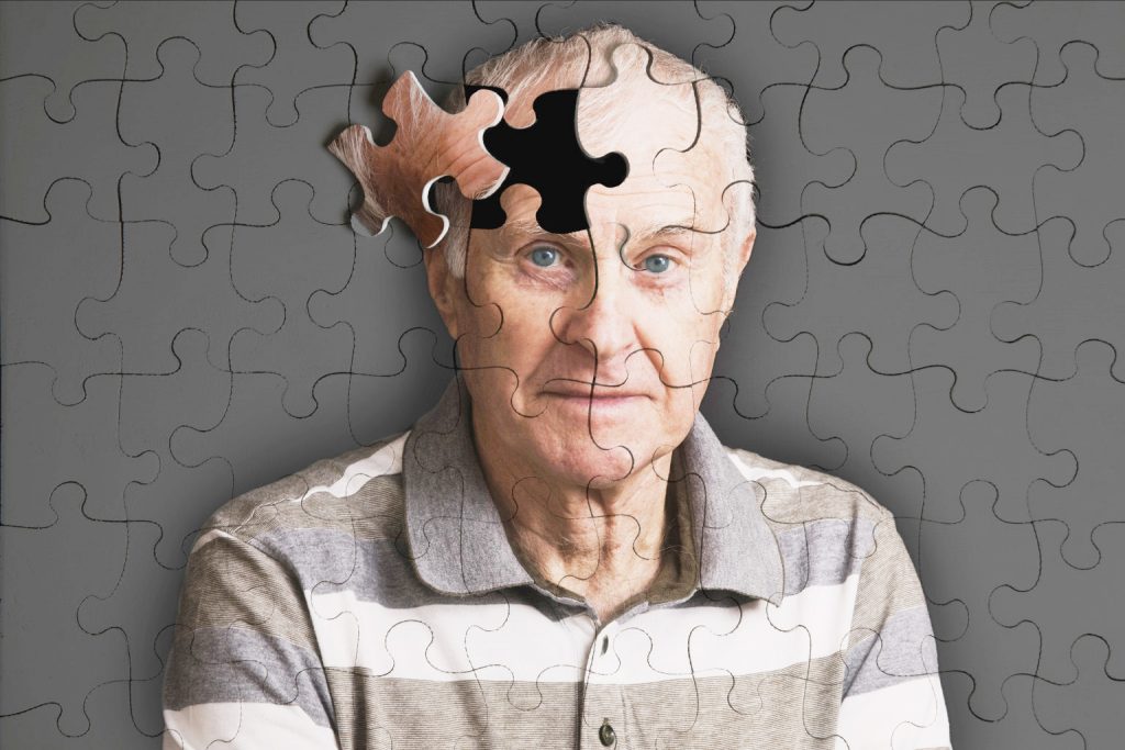 Ученые-биохимики из Канады нашли новую причину болезни Альцгеймера