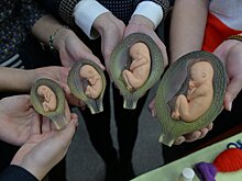 Сто лет аборту: ошибки без срока давности
