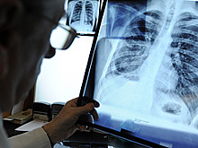 Минздрав прогнозирует снижение мужской смертности в России