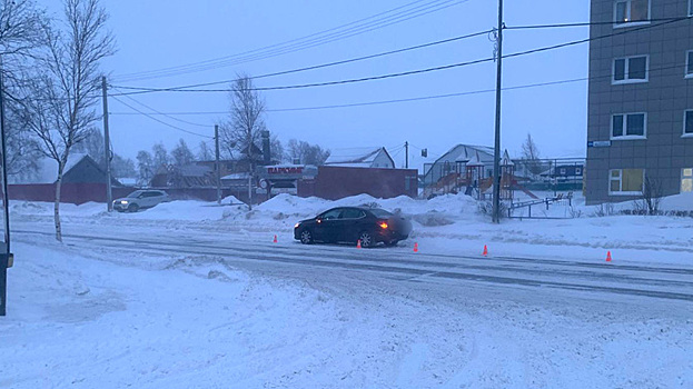 В Сургуте маленькая девочка попала под машину, перебегая дорогу