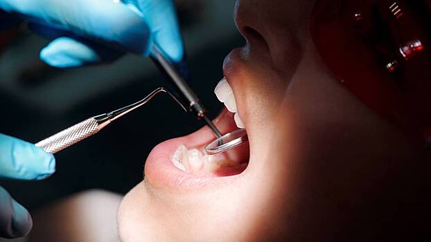 Хирург объяснил, почему россияне избегают походов к стоматологам