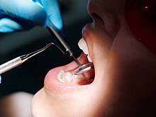 Хирург объяснил, почему россияне избегают походов к стоматологам