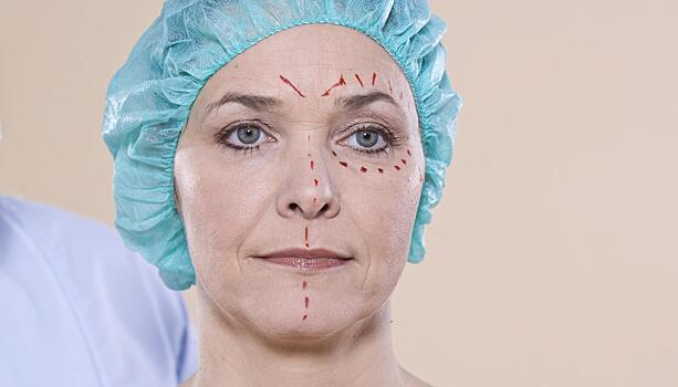 Подготовка к блефаропластике: что нужно знать перед операцией