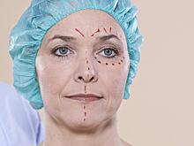 Подготовка к блефаропластике: что нужно знать перед операцией