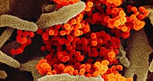 Названы клетки, наиболее восприимчивые к коронавирусу: плохие новости