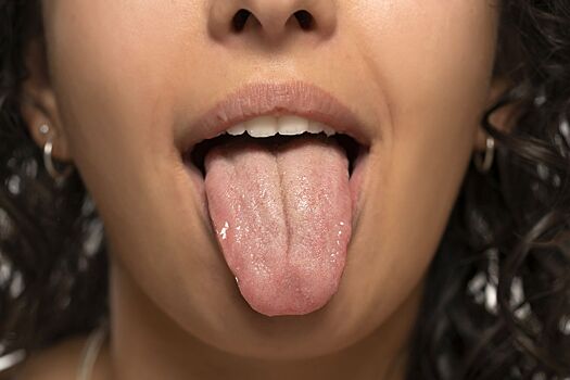 Два малоизвестных признака сахарного диабета можно обнаружить во рту