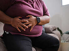 Онколог Стилиди: треть злокачественных опухолей связана с избыточной массой тела