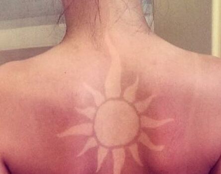Врач: "солнечные татуировки" опасны для здоровья