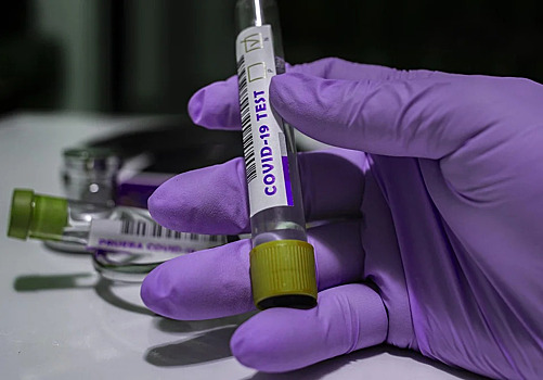 В Пензе за сутки выявлено 74 случая коронавируса