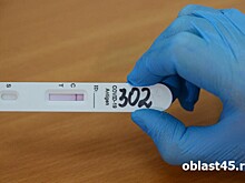 Коронавирус у 6% зауральцев: какие вирусы циркулируют в регионе