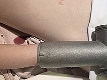 В Воронеже 3-летнему мальчику спасли руку, попавшую в электромясорубку