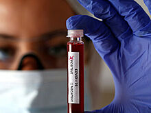 Вирус из пробирки: Почему Запад резко поменял версию о COVID