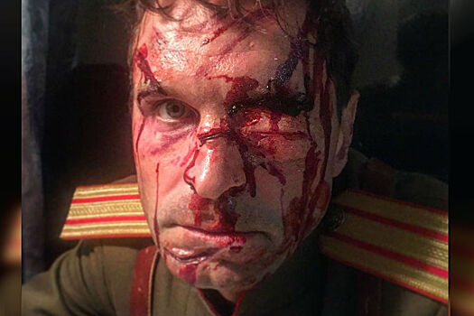 «Люблю свою работу»: Виктор Добронравов опубликовал фото с разбитым лицом