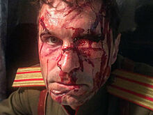 «Люблю свою работу»: Виктор Добронравов опубликовал фото с разбитым лицом