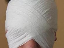 Москвич пожаловался врачам на пулю в голове, с которой он живёт больше 17 лет