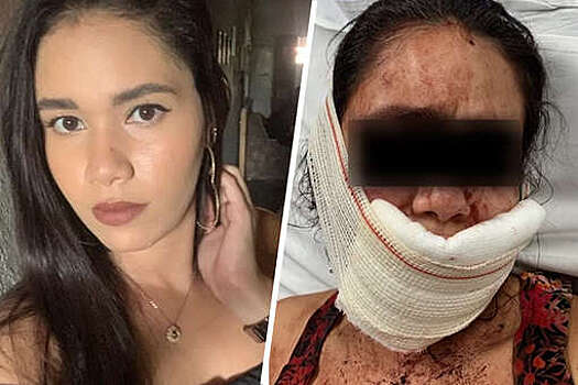 Metropoles: в Бразилии мужчина в гневе накинулся на свою девушку и искусал ее лицо